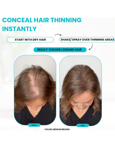 Paquete Fibra para Cabello SureThik - 15g + Spray 90ml