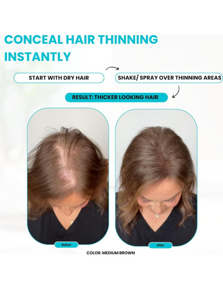 Paquete Fibra para Cabello SureThik - 15g + Spray 90ml Paquete Fibra para Cabello SureThik - 15g + Spray 90ml