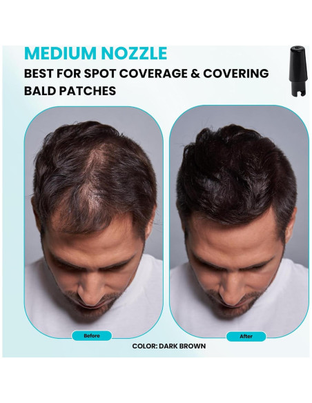 Paquete Fibra para Cabello SureThik - 15g + Spray 90ml Paquete Fibra para Cabello SureThik - 15g + Spray 90ml