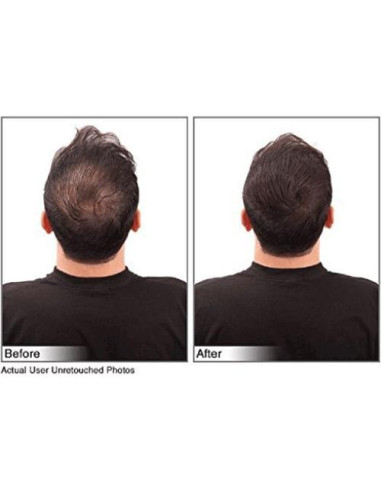 Fibras para Cabello JUVEKER 28g Ocultan Calvas y Ralo