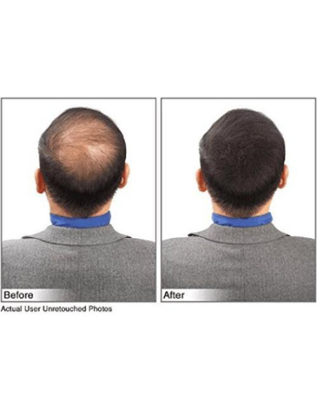 Fibras para Cabello JUVEKER 28g Ocultan Calvas y Ralo