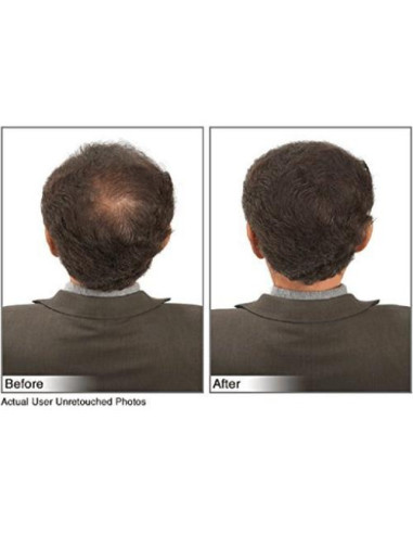 Fibras para Cabello JUVEKER 28g Ocultan Calvas y Ralo