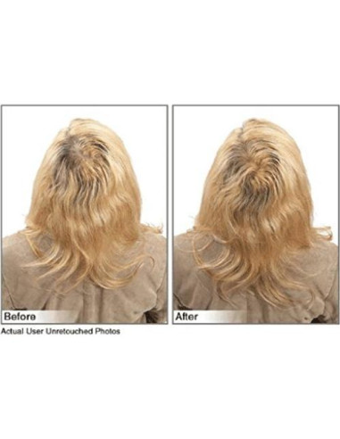 Fibras para Cabello JUVEKER 28g Ocultan Calvas y Ralo