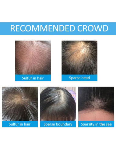 Fibras para Cabello SHIFAKOU 27.5g Negro - Aplicador Spray