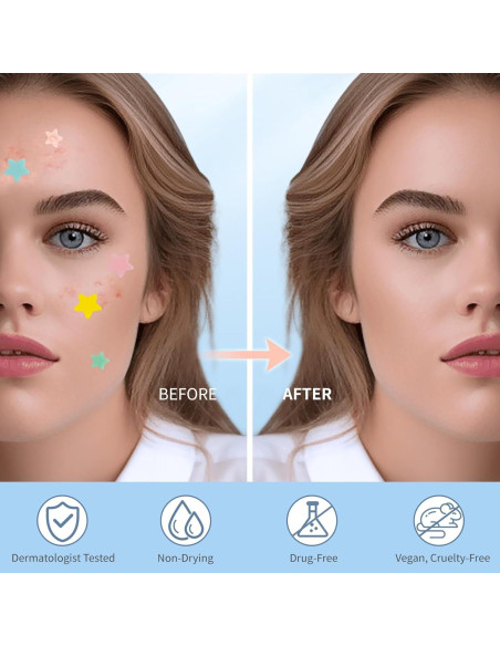 Parche para Granos QUSTERE 200 Unidades Hidrocoloides