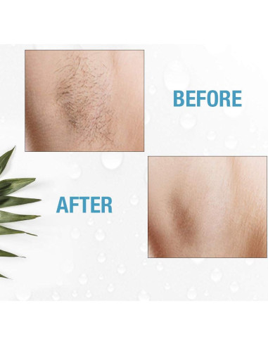 Máquina de Electrólisis Clean + Easy para Vello Facial y Corporal