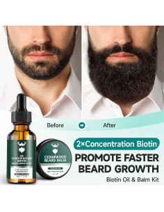 Kit de Crecimiento de Barba MistySprite 2X Biotina Aceites Naturales 2