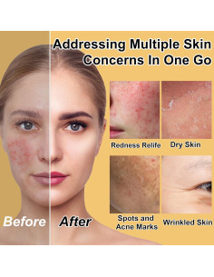 Set de Cuidado de la Piel GOWLAVER para Adolescentes Hidratante 2