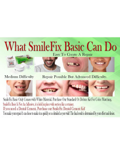 SmileFix Reparación Dental Básica - Dientes Faltantes y Rotos 2