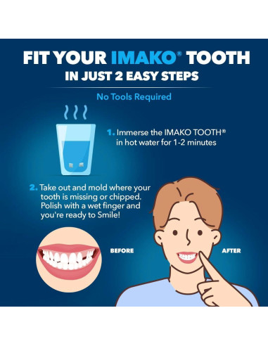 Imako Diente Temporal Plástico Color Natural - Ajuste Rápido