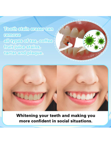 Kit de Limpieza Dental Sibba 8 Piezas Removedores de Manchas