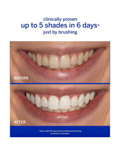 Acelerador Blanqueamiento Profesional Supersmile 136 g 2