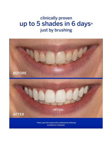 Acelerador Blanqueamiento Profesional Supersmile 136 g
