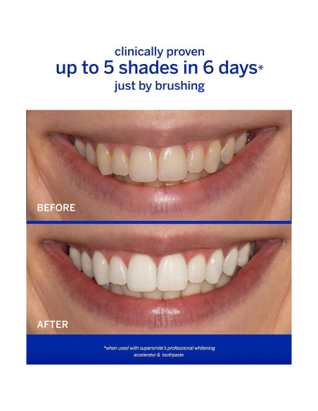 Acelerador Blanqueamiento Profesional Supersmile 136 g