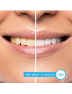 GO SMILE Gel Blanqueador y Pasta de Dientes 96g - Sin Sensibilidad 2