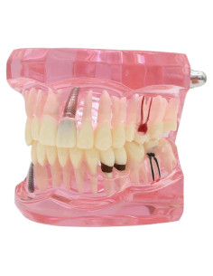 Modelo de Dientes XINGXING 2001 para Estudio Dental