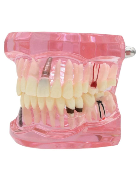 Modelo de Dientes XINGXING 2001 para Estudio Dental