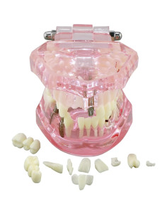 Modelo de Dientes XINGXING 2001 para Estudio Dental 2