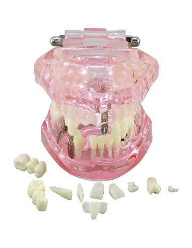 Modelo de Dientes XINGXING 2001 para Estudio Dental