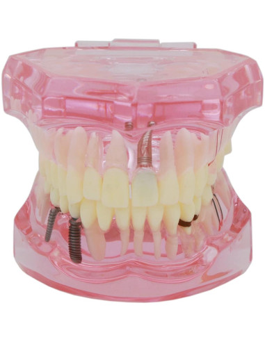 Modelo de Dientes XINGXING 2001 para Estudio Dental