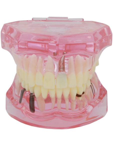 Modelo de Dientes XINGXING 2001 para Estudio Dental