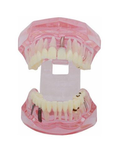 Modelo de Dientes XINGXING 2001 para Estudio Dental