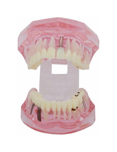 Modelo de Dientes XINGXING 2001 para Estudio Dental