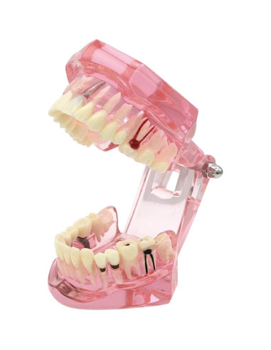 Modelo de Dientes XINGXING 2001 para Estudio Dental