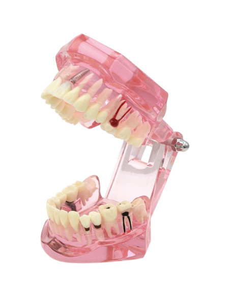 Modelo de Dientes XINGXING 2001 para Estudio Dental