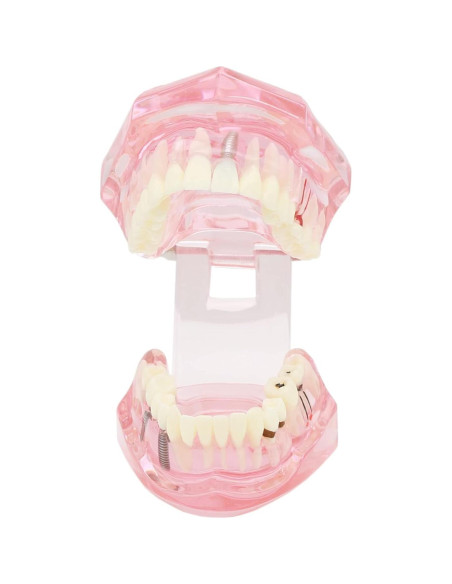 Modelo de Dientes XINGXING 2001 para Estudio Dental