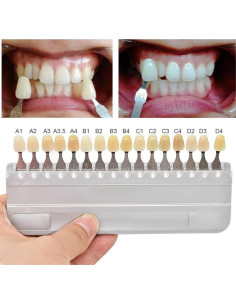 Guía de Sombra Dental Jashem 16 Colores para Blanqueamiento 2