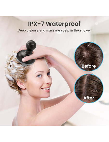 Masajeador Eléctrico COMFIER CF-4902BLK para Cuero Cabelludo